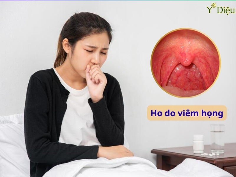 Ho Do Viêm Họng Là Gì? Nguyên Nhân Và Cách Điều Trị