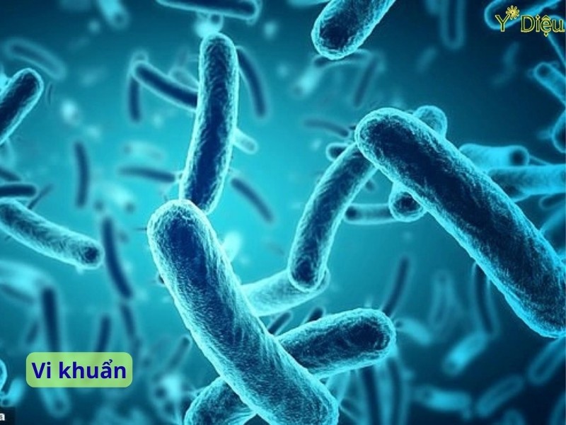 Vi khuẩn là gì? Khám phá thế giới vi sinh vật kỳ diệu